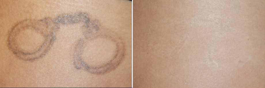 fe-tatuering-3