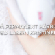 30% Rabatt på permanent hårborttagning med laser i Kristinehamn